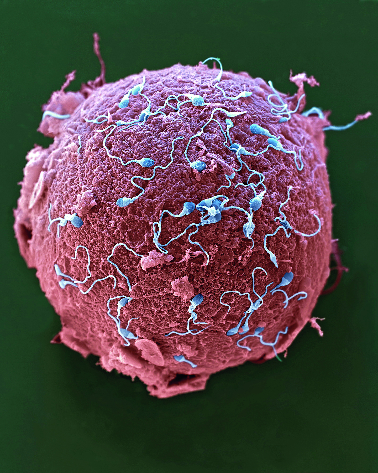 Fotografia. Estrutura circular e rosada com várias estruturas menores de coloração azul e formato arredondado que se prolonga em um filamento (espermatozoides) ao seu redor.