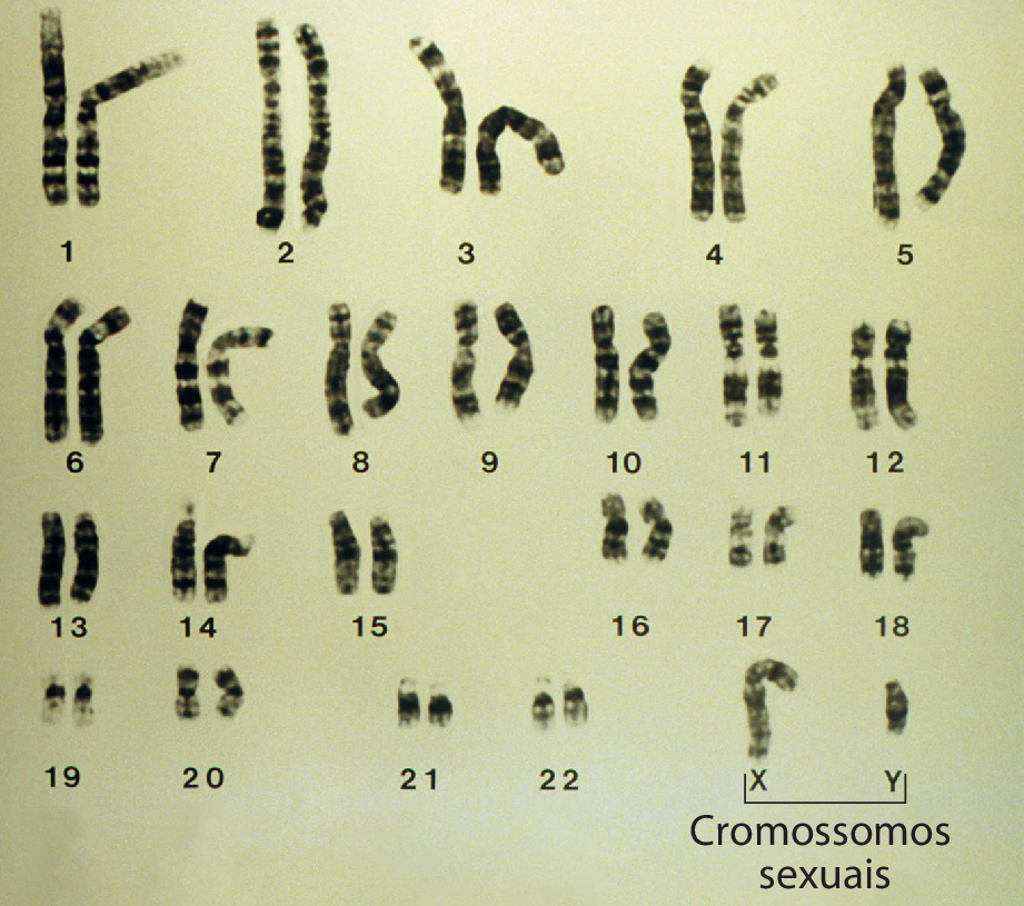 Fotografia. 23 pares de cromossomos. São filamentos escuros e alongados. Alguns são mais compridos em relação a outros. Alguns são mais curvados que outros. No canto direito inferior, destaque para o cromossomo X e para o cromossomo Y que são cromossomos sexuais. O cromossomo Y é menor que o cromossomo X.