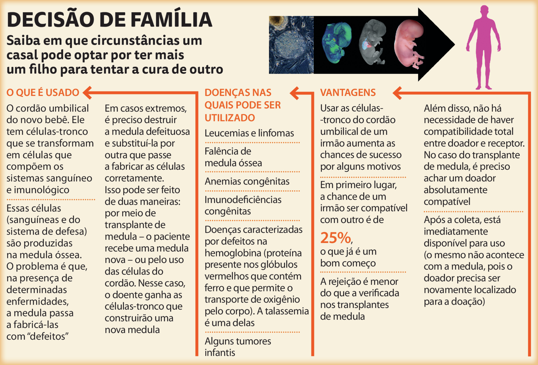 Ilustração de uma seta com quatro fotografias. Forma arredondada com detalhes no interior. Um feto pouco desenvolvido. Um feto com cabeça braços e pernas formados, além do coração. Feto mais desenvolvido, com cabeça maior, braços e pernas. Ao lado, silhueta de um ser humano em pé. Ao lado, as informações:
DECISÃO DE FAMÍLIA.
Saiba em que circunstâncias um casal pode optar por ter mais um filho para tentar a cura de outro.
Abaixo:
O QUE É USADO.
O cordão umbilical do novo bebê. Ele tem células-tronco que se transformam em células que compõem os sistemas sanguíneo e imunológico.
Essas células (sanguíneas e do sistema de defesa) são produzidas na medula óssea. O problema é que, na presença de determinadas enfermidades, a medula passa a fabricá-las com “defeitos”.
Em casos extremos, é preciso destruir a medula defeituosa e substituí-la por outra que passe a fabricar as células corretamente. Isso pode ser feito de duas maneiras: por meio de transplante de medula – o paciente recebe uma medula nova – ou pelo uso das células do cordão. Nesse caso, o doente ganha as células-tronco que construirão uma nova medula.
DOENÇAS NAS QUAIS PODE SER UTILIZADO.
Leucemias e linfomas.
Falência de medula óssea.
Anemias congênitas.
Imunodeficiências congênitas.
Doenças caracterizadas por defeitos na hemoglobina (proteína presente nos glóbulos vermelhos que contém ferro e que permite o transporte de oxigênio pelo corpo). A talassemia é uma delas.
Alguns tumores Infantis.
VANTAGENS.
Usar as células-tronco do cordão umbilical de um irmão aumenta as chances de sucesso por alguns motivos.
Em primeiro lugar, a chance de um irmão ser compatível com outro é de 25%, o que já é um bom começo A rejeição é menor do que a verificada nos transplantes de medula.
Além disso, não há necessidade de haver compatibilidade total entre doador e receptor. No caso do transplante de medula, é preciso achar um doador absolutamente compatível.
Após a coleta, está imediatamente disponível para uso (o mesmo não acontece com a medula, pois o doador precisa ser novamente localizado para a doação).