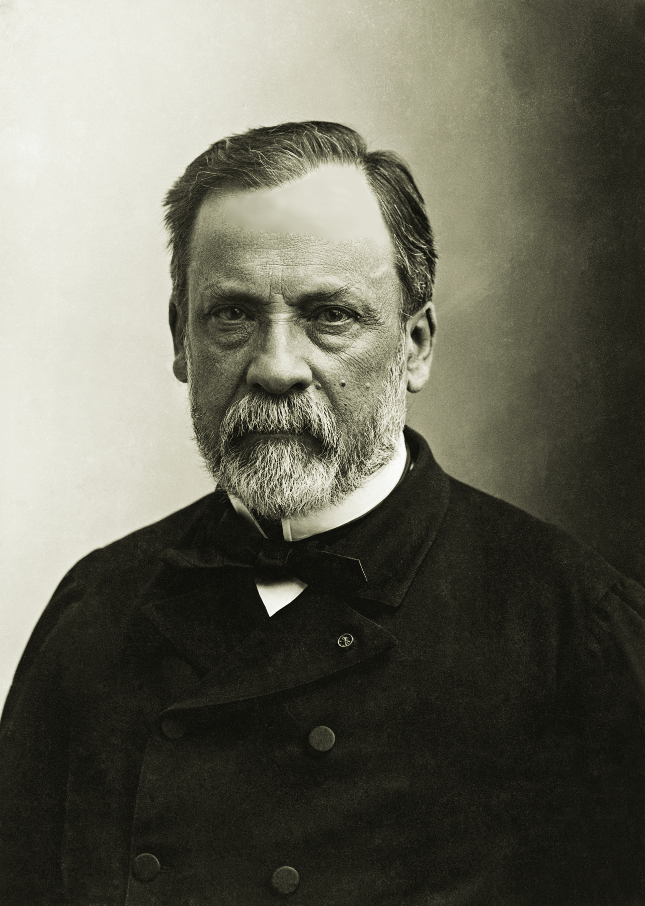 Fotografia em preto e branco. Homem com a descrição na foto sendo Louis Pasteur que viveu entre 1 mil 822 e 1 mil 895, de cabelo escuro com barba grisalha, uma verruga na bochecha, está usando um casaco preto e uma gravata borboleta preta.