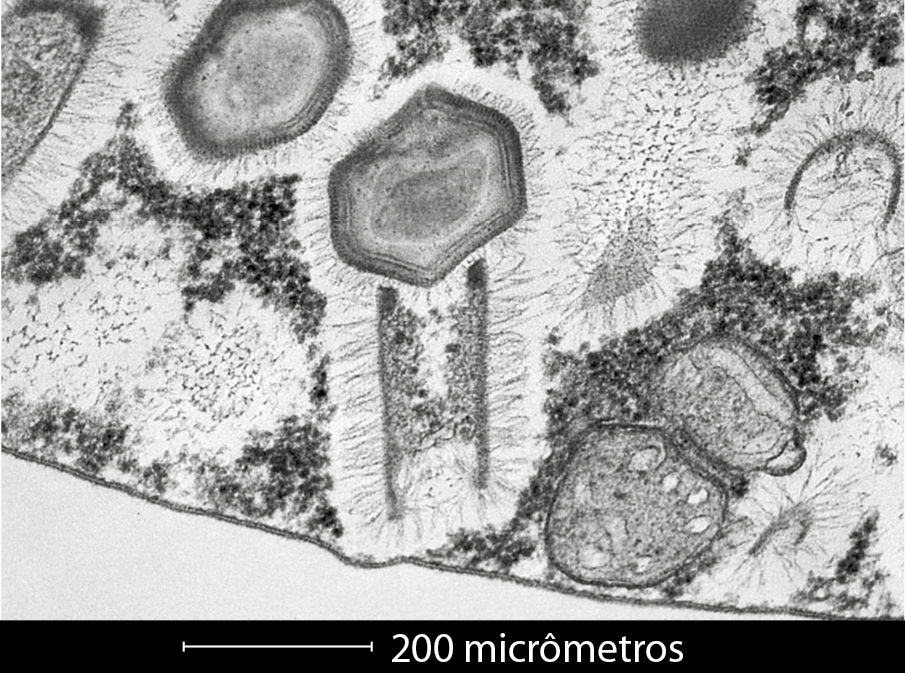 Fotografia. Visão microscópica de vírus. Círculos, manchas, figuras distorcidas, pontos e traços em preto, no fundo branco.
Abaixo, traço horizontal limitado por dois traços menores na vertical, 200 micrômetros.