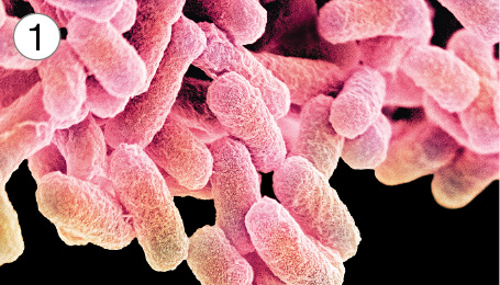 Imagem: Fotografia microscópica 1. Em fundo de cor preta, vários gomos cilíndricos de cor rosa, com camada grossa.  Fim da imagem.