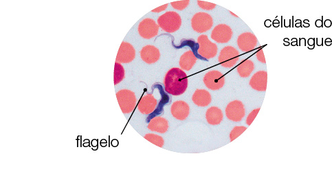 Imagem: Fotografia microscópica. Vários círculos de cor rosa claro e um em rosa-escuro : células do sangue. Perto dos círculos, filamento fino de cor azul-escuro: flagelo.  Fim da imagem.