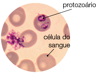 Imagem: Fotografia microscópica. Formas arredondadas escuras com parte arredonda mais clara dentro : célula do sangue. Sobre algumas dessas formas, manchas pequenas de cor roxa : protozoário.  Fim da imagem.