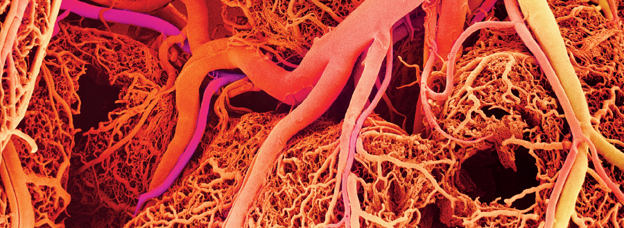 Imagem: Fotografia microscópica. Tubos grossos, médios em tons de laranja, rosa, amarelo sobre tubos mais finos emaranhados de cor laranja.  Fim da imagem.