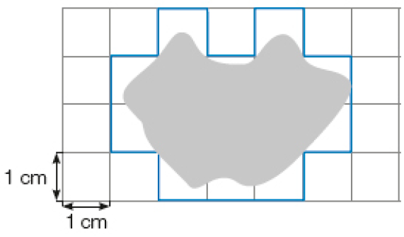 Ilustração. Malha quadriculada. Cada quadradinho mede 1 cm de comprimento e 1 cm de largura. No centro há uma mancha ocupando quinze quadradinhos. Em volta da mancha, os quadradinhos estão destacados. 