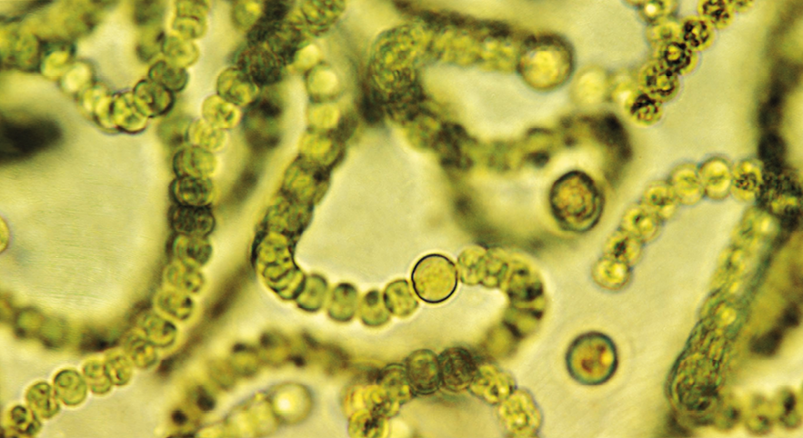 Fotografia obtida com microscópio de alguns organismos esverdeados redondos isolados e de vários desses organismos alongados unidos formando cordões.