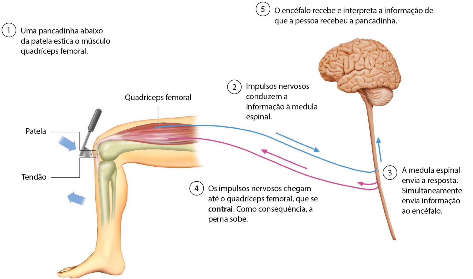 Esquema. Perna de uma pessoa com o joelho flexionado, mostrando músculo, ossos e tendão. No joelho, linha de chamada para patela e tendão. Na coxa, linha de chamada para quadríceps femoral. Há um martelo na frente do joelho e na frente da cabeça do martelo uma seta na diagonal para baixo. Em frente à perna, seta na diagonal para cima. 1: Uma pancadinha abaixo da patela estica o músculo quadríceps femoral. Uma linha azul com seta para a direita vai até a estrutura alongada da ilustração do SNC. 2: Impulsos nervosos conduzem a informação à medula espinal. 3: A medula espinal envia a resposta. Simultaneamente envia informação ao encéfalo. Da medula sai linha e seta lilás em direção à perna e seta azul em direção à parte superior do SNC. 4: Os impulsos nervosos chegam até o quadríceps femoral, que se contrai. Como consequência, a perna sobe. 5: O encéfalo recebe e interpreta a informação de que a pessoa recebeu a pancadinha.