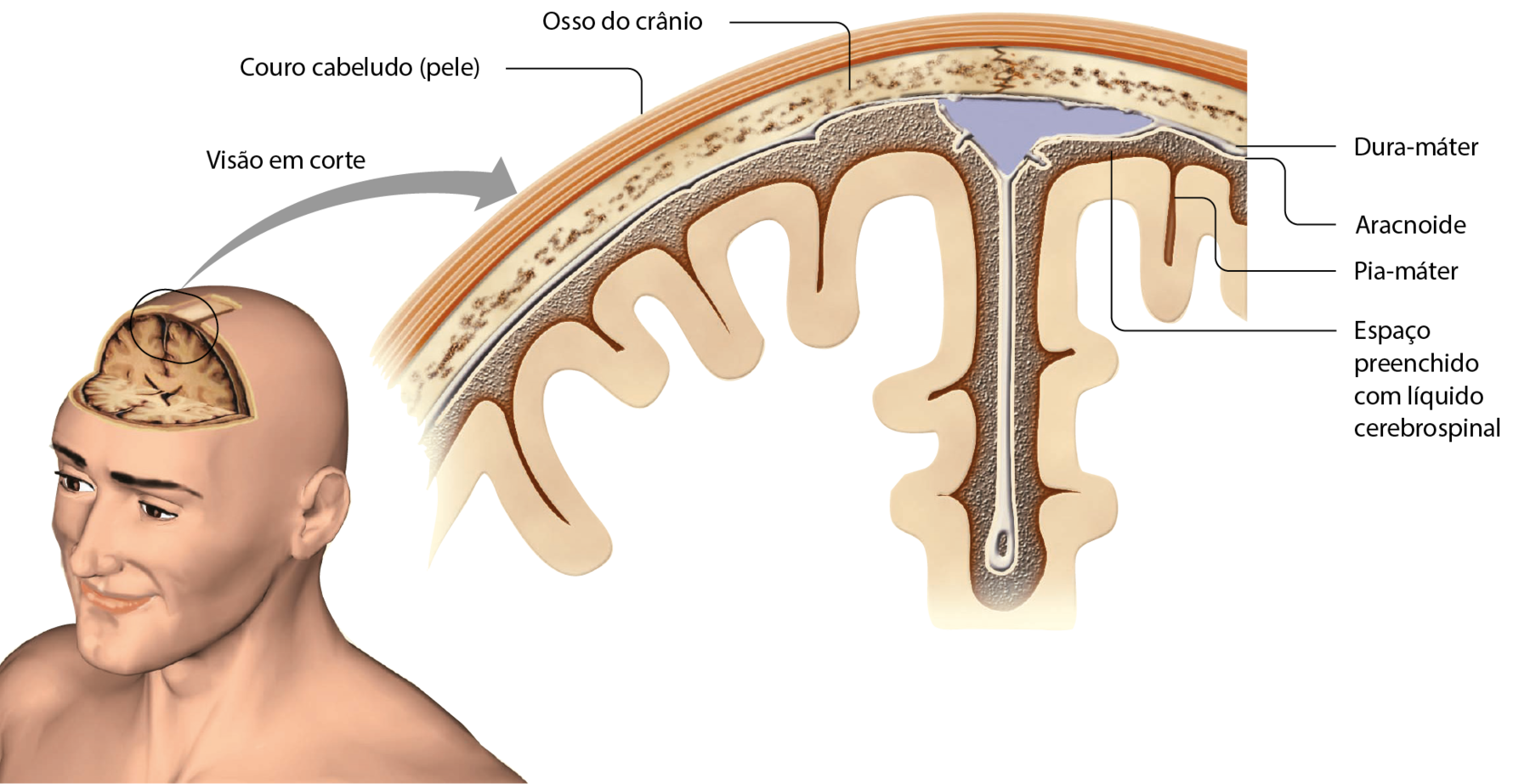 Ilustração. Busto de uma pessoa branca e sem cabelo com um pedaço da cabeça faltando, correspondente à testa e ao topo, mostrando as partes internas. Do centro do topo, seta para destaque (visão em corte). Camadas de fora para dentro: couro cabeludo (pele), osso do crânio, dura-máter, aracnoide, espaço preenchido com líquido cerebrospinal, pia-máter. O desenho também mostra na sequência o córtex cerebral.