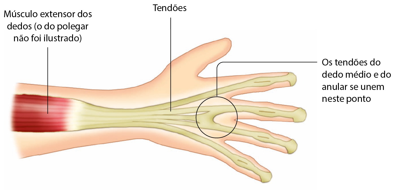 Ilustração. Mão de uma pessoa com músculo e tendões em destaque. Na porção final do antebraço, linha de chamada para: músculo extensor dos dedos (o do polegar não foi ilustrado). Do dorso da mão, linha de chamada para: tendões. Da base dos dedos, linha de chamada para: os tendões do dedo médio e do anular se unem neste ponto.