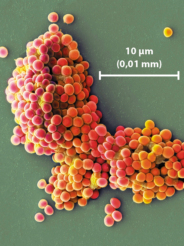 Fotografia. Imagem de vários organismos unicelulares de forma arredondada em tons de laranja, aglomerados formando um combinado irregular. Na região inferior da fotografia, uma barra de escala indica: 10 micrômetros (0,01 milímetro).