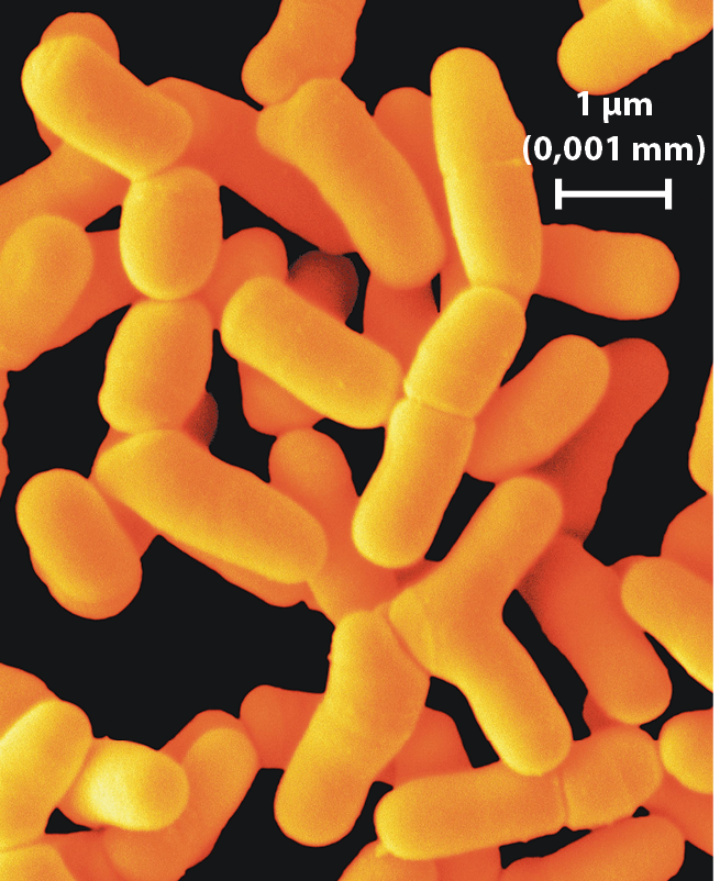 Fotografia. Imagem de organismos em forma de bastão em amarelo.  Na região inferior da fotografia, uma barra de escala indica: 1 micrômetro (0,001 milímetro).