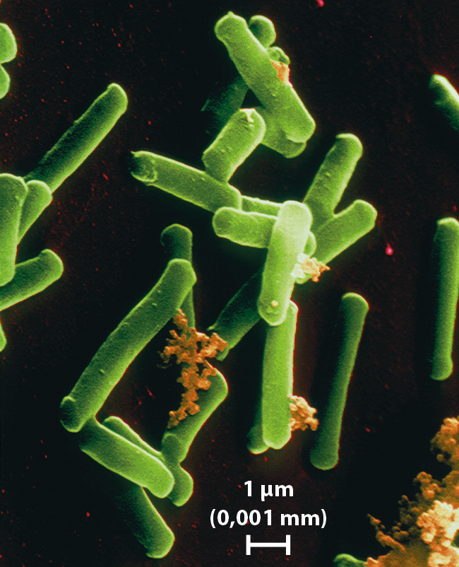 Fotografia. Imagem de organismos em forma de bastão em verde. Na região inferior da fotografia, uma barra de escala indica: 1 micrômetro (0,001 milímetro).