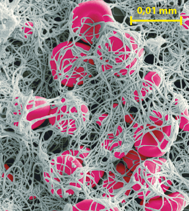 Fotografia. Imagem de microscópio mostrando estruturas discoidais cor-de-rosa envoltas por um emaranhado de fios brancos.