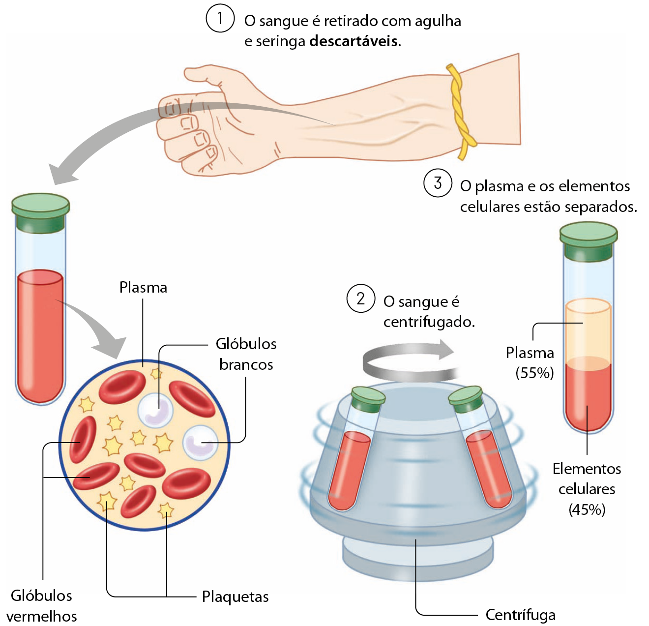 Esquema. 1: O sangue é retirado com agulha e seringa descartáveis. Ilustração do braço de uma pessoa com um garrote amarrado próximo ao cotovelo. Seta para um tubo de ensaio com líquido vermelho dentro. Seta para imagem de microscópio, com estruturas discoidais vermelhas representando glóbulos vermelhos, estruturas amarelas em forma de estrela  representando plaquetas e estruturas esféricas brancas representando os glóbulos brancos. 2: o sangue é centrifugado. Ilustração de um suporte redondo, centrífuga, com dois tubos de ensaio com líquido vermelho, com seta representando o sentido de rotação. 3: o plasma e os elementos celulares estão separados. Ilustração de um tubo de ensaio com um líquido vermelho na parte inferior, elementos celulares (45%), e líquido amarelo em cima, plasma (55%).