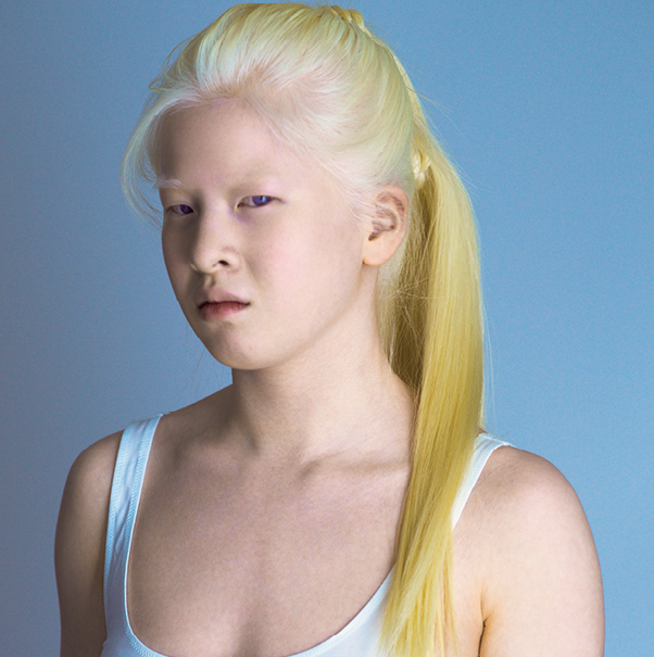Fotografia. Menina de pele branca, com cabelo e sobrancelhas brancos.