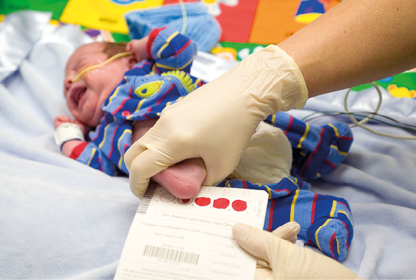 Fotografia. Destaque para uma mão com luvas pressionando o pé de um bebê, do qual sai gotas de sangue. As gotas de sangue são depositadas sobre um papel.