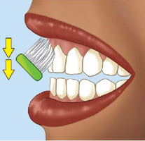 IMAGEM: uma escova posicionada na face externa dos dentes superiores de uma boca, com setas apontando para baixo. FIM DA IMAGEM.