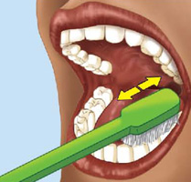 IMAGEM: uma escova posicionada na superfície dos dentes de trás de uma boca, com setas apontando para ambos os lados. FIM DA IMAGEM.