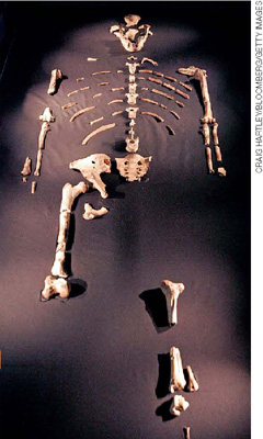 IMAGEM: alguns ossos dispostos sobre um fundo escuro, compondo parte de um esqueleto humano. FIM DA IMAGEM.
