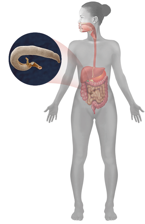 Imagem: Ilustração. Corpo de uma mulher em corte mostrando a ligação da boca até o intestino. Ao lado, destaque de um verme que habita no interior do corpo. Fim da imagem.