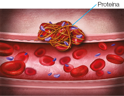 Imagem: Ilustração. Uma corrente de sangue com aglomerado de proteína amarrada no centro da imagem ligada na estrutura da corrente. Fim da imagem.