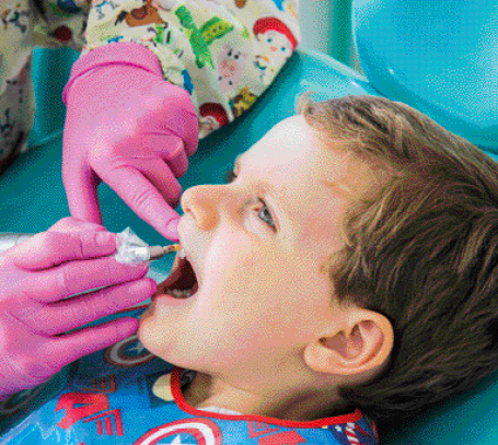 Imagem: Fotografia. Um menino está sentado com a boca aberta. Ao seu lado há duas mãos com luvas segurando um instrumento sobre sua boca. Fim da imagem.