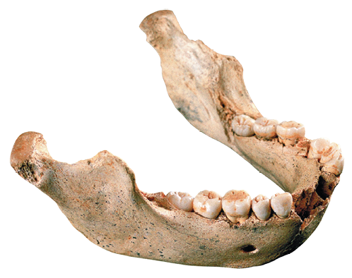 Imagem: Fotografia. Mandíbula conservada que apresenta arcada com poucos dentes faltantes. Fim da imagem.