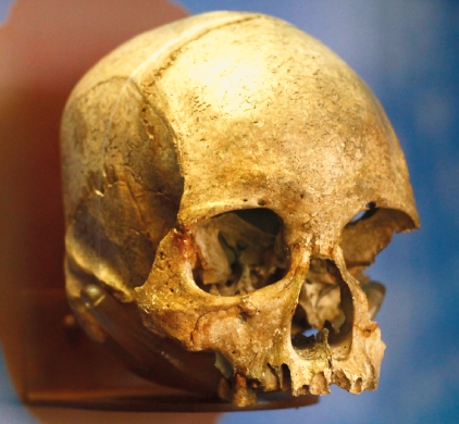 Imagem: Fotografia. Um crânio que apresenta parte superior lisa e grande, as cavidades dos olhos e nariz e parte da arcada dentária superior. Fim da imagem.