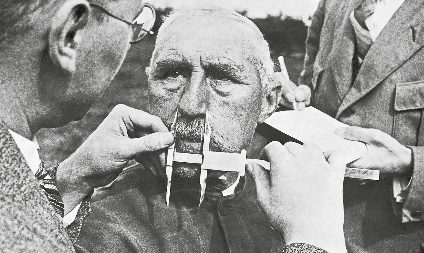 Fotografia em preto e branco. Homem medindo o nariz de um senhor com a ajuda de um instrumento de medição. Atrás, outra pessoa faz anotações.