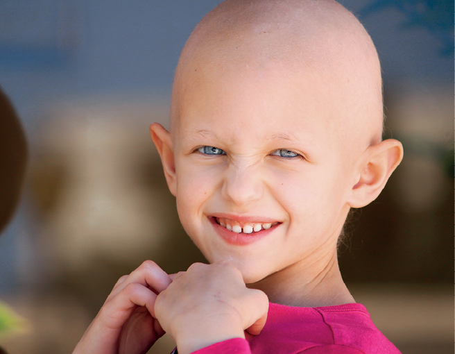 Fotografia. Criança sorridente, careca e sem sobrancelhas. Tem olhos azuis.