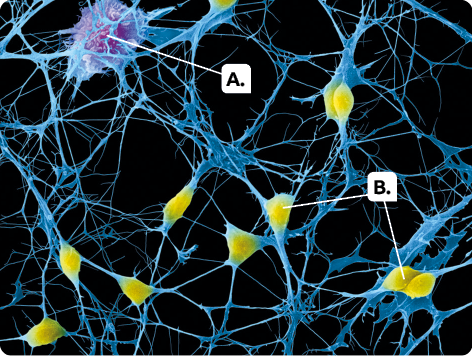 Fotografia. Células nervosas em crescimento. Indicado pela letra A, um gliócito, forma grande e arredondada em roxo, com ramificações. Indicados com a letra B, alguns neurônios, formas pequenas e arredondadas em amarelo, que se conectam às ramificações.