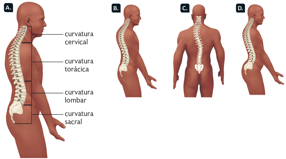 Ilustrações. À esquerda, na ilustração A, silhueta de corpo humano representado de perfil, com destaque para a coluna vertebral, dividida em 4 regiões. Na parte superior, na região da cabeça até o início dos ombros, a curvatura cervical. Abaixo, aproximadamente até metade da região das costas, a curvatura torácica; embaixo, na região da lombar, a curvatura lombar; na extremidade inferior, a curvatura sacral. Na ilustração B, silhueta de corpo humano representado de perfil e com a coluna vertebral em destaque, com curvatura torácica acentuada para fora, hipercifose. Na ilustração C, silhueta de pessoa representada de costas e com a coluna vertebral em destaque, com a curvatura torácica acentuada para a esquerda, escoliose. E na ilustração D,  silhueta de pessoa representada de perfil e com a coluna vertebral em destaque, com curvatura lombar acentuada para dentro, hiperlordose. 