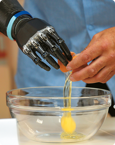 Fotografia das mãos de uma pessoa quebrando um ovo sobre um recipiente, sendo que uma delas é uma prótese. Ela é feita de materiais plásticos e estruturas metálicas.
