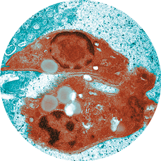 Fotografia de um protozoário de coloração avermelhada e forma irregular.