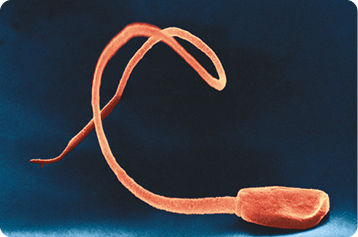 Fotografia de um espermatozoide, com uma estrutura arredondada em uma extremidade e cauda alongada e curva na outra.