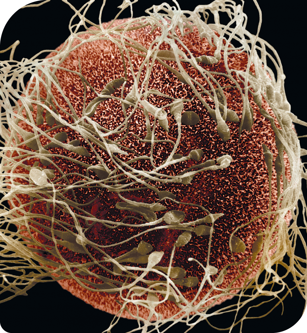 Fotografia. Um ovócito, forma esférica com aspecto poroso, com vários espermatozoides ao redor, células que possuem cabeça com ponta em uma extremidade e cauda na outra extremidade.