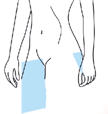 Ilustração. Uma silhueta de uma mulher em pé representada do tórax para baixo, com destaque para a região genital. Há um retângulo que representa um plano de corte na região destacada.