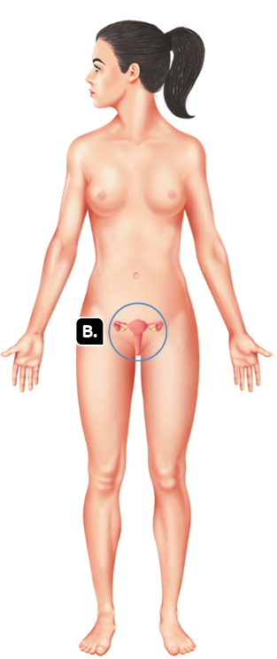 Ilustração. Uma silhueta de uma mulher em pé, com destaque para a região genital marcada com a letra B.