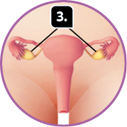 Ilustração. Região genital feminina. Indicado com o número 3, os ovários, estruturas ovaladas que ficam nas laterais e estão ligadas as tubas uterinas, estruturas longas e onduladas com projeções nas pontas.