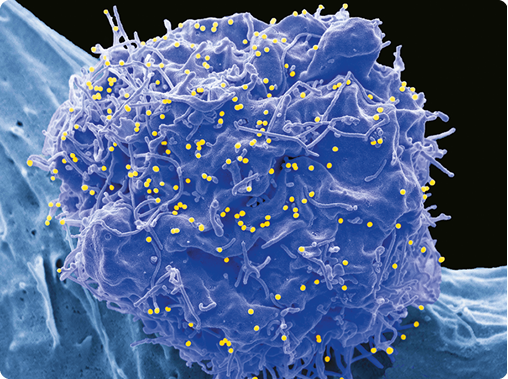 Fotografia. Uma célula azul, com formato aproximadamente esférico e a superfície irregular, com filamentos ao redor dela. Na superfície há pequenos pontos amarelos.