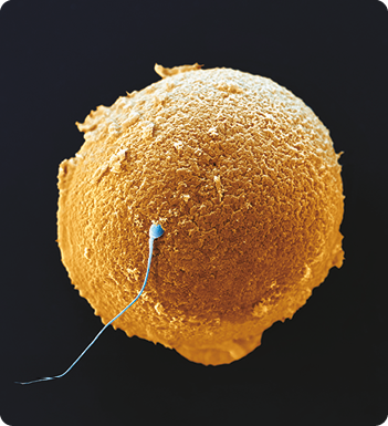 Fotografia. Um ovócito, esfera com aspecto poroso e um espermatozoide azul em sua superfície.