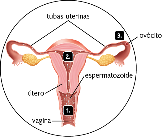 Ilustração. Destaque para as estruturas internas do sistema genital feminino. Marcada com o número 1, a vagina com muitos espermatozoides dentro dela. Marcado com o número 2, os espermatozoides passam por entre o útero. Marcado com o número 3, os espermatozoides chegam às tubas uterinas, onde há também uma esfera, o ovócito.