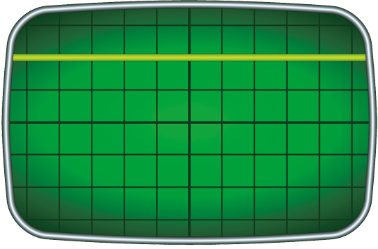 Ilustração de um visor verde com o fundo quadriculado e uma linha reta amarela.