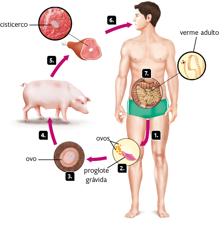 Esquema com ilustrações. Ciclo de vida de um platelminto parasita. Silhueta de um homem em pé com destaque para o intestino. Marcada com o número 1, uma seta apontando para baixo parte da região inferior do corpo humano. Marcada com o número 2, destaque para uma estrutura plana e quadrada, a proglote grávida. Ao lado, ovos aglomerados. Seta apontando para o número 3, uma estrutura circular com esfera dentro, o ovo. Seta indicando o número 4 e apontando para um porco, animal robusto com quatro patas, orelhas pequenas, focinho quadrado e rabo enrolado. Seta indicando o número 5 e apontando para um pedaço de carne suína, com osso na extremidade. Destaque para o centro da carne com uma forma arredondada e branca, o cisticerco. Seta indicando o número 6 e apontando para a boca do ser humano. Marcado com o número 7, destaque para o intestino grosso e intestino delgado, com o verme adulto, que é comprido e achatado, com cabeça arredondada e bolinha preta ao centro.