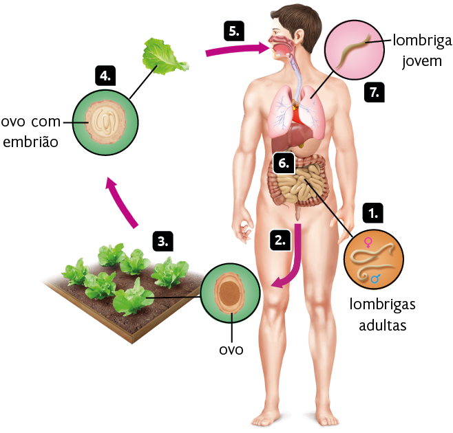 Esquema com ilustrações. Ciclo de vida de Ascaris lumbricoides.  Esquema. Silhueta de um homem em pé com destaque para o intestino. Indicadas com o número 1, destaque para duas lombrigas adultas, uma fêmea e um macho, no intestino. Marcada com o número 2, uma seta para baixo, saindo do intestino humano em direção ao ovo em destaque, composto por uma forma arredondada e marrom, com uma esfera dentro. Marcado com o número 3, um espaço com terra e plantas verdes plantadas, onde o ovo está presente nelas. Seta apontando para o número 4, uma folha verde de um vegetal, com destaque para um ovo com embrião, forma arredondada com lombrigas dentro. Seta indicando o número 5 e apontando para a boca do humano. Marcado com o número 6, o intestino do humano. Marcado com o número 7, em destaque, uma lombriga jovem localizada no pulmão.