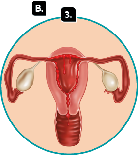 Ilustração. Marcada com a letra B, destaque para as estruturas internas do sistema genital feminino. Indicado com o número 3, no útero, camada de sangue ao redor e escorrendo em direção à vagina.
