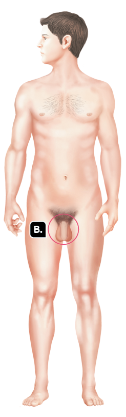 Ilustração. Uma silhueta de um homem em pé, com destaque para a região genital marcada com a letra B.