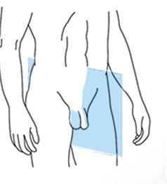 Ilustração. Uma silhueta de um homem em pé representada do tórax para baixo, com destaque para a região genital. Há um retângulo que representa um plano de corte na região destacada.
