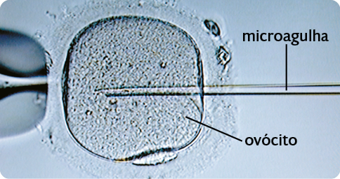 Fotografia. Uma forma arredondada, indicada como ovócito, e uma haste fina e comprida, com a ponta dentro da forma arredondada. Nessa haste há a seguinte indicação: microagulha.